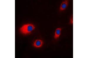 Immunofluorescent analysis of CLCN7 staining in HeLa cells. (CLCN7 Antikörper  (N-Term))