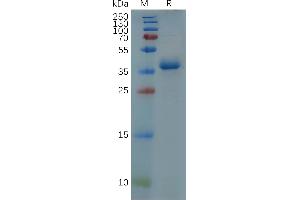 Human GFAP(7-66) Protein, hFc Tag on SDS-PAGE under reducing condition. (GFAP Protein (AA 7-66) (Fc Tag))