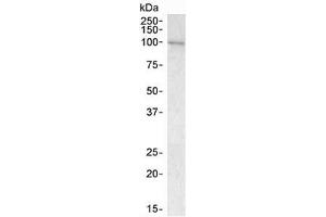 Western blot testing of human bone marrow lysate with VAV3 antibody at 1ug/ml. (VAV3 Antikörper)