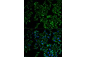 Immunofluorescence analysis of HeLa cells using TNFRSF1A antibody (ABIN1875131). (TNFRSF1A Antikörper)
