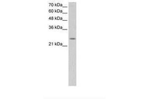 Image no. 2 for anti-Fatty Acid Hydroxylase Domain Containing 2 (FAXDC2) (N-Term) antibody (ABIN6736644) (C5ORF4 Antikörper  (N-Term))