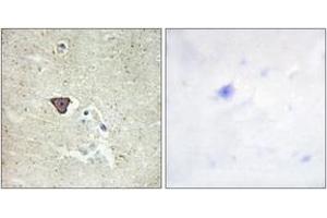 Immunohistochemistry analysis of paraffin-embedded human brain tissue, using CDH9 Antibody. (Cadherin 9 Antikörper  (AA 201-250))