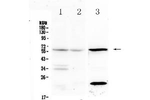 Western blot analysis of IL23 Receptor using anti-IL23 Receptor antibody . (IL23R Antikörper  (AA 25-233))