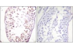 Immunohistochemistry analysis of paraffin-embedded human testis, using HDAC6 (Phospho-Ser22) Antibody. (HDAC6 Antikörper  (pSer22))