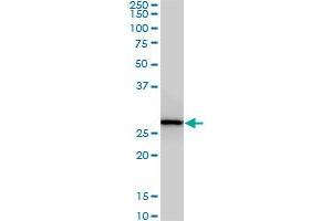 CNOT7 monoclonal antibody (M01A), clone 2F6. (CNOT7 Antikörper  (AA 1-285))