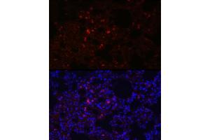 Immunofluorescence analysis of rat lung using SFTPC Rabbit pAb (ABIN3015597, ABIN3015598, ABIN3015599, ABIN1682683 and ABIN6218961) at dilution of 1:100 (40x lens). (Surfactant Protein C Antikörper  (AA 1-197))