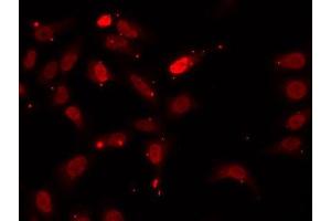 Immunofluorescence analysis of U2OS cells using HNRNPF antibody. (HNRNPF Antikörper  (AA 1-280))