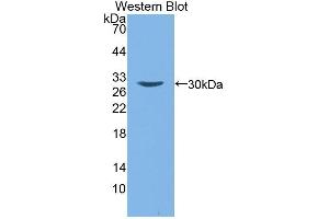 Detection of Recombinant ALOX15B, Human using Polyclonal Antibody to 15-Lipoxygenase-2 (15-LO-2) (ALOX15B Antikörper  (AA 253-490))