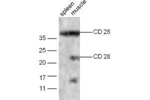 Mouse spleen probed with Rabbit Anti-CD28 Polyclonal Antibody Unconjugated  at 1:5000 for 90 min at 37˚C. (CD28 Antikörper  (AA 19-69))