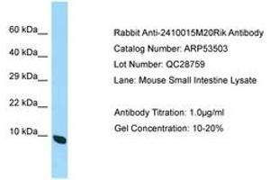 Image no. 1 for anti-Chromosome 19 Open Reading Frame 70 (C19ORF70) (AA 63-112) antibody (ABIN6749927) (Chromosome 19 Open Reading Frame 70 (C19ORF70) (AA 63-112) Antikörper)