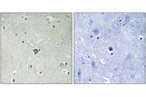 Immunohistochemistry (IHC) image for anti-BCL2-Associated X Protein (BAX) (AA 143-192) antibody (ABIN2889141) (BAX Antikörper  (AA 143-192))
