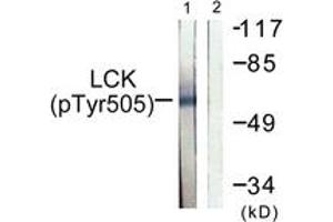 Western blot analysis of extracts from Jurkat cells, using Lck (Phospho-Tyr505) Antibody. (LCK Antikörper  (pTyr505))
