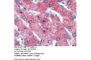 Immunohistochemistry with Human Liver cell lysate tissue at an antibody concentration of 5. (ZNF777 Antikörper  (Middle Region))
