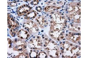 Immunohistochemical staining of paraffin-embedded Kidney tissue using anti-PPME1mouse monoclonal antibody. (PPME1 Antikörper)