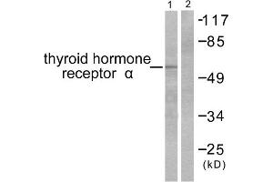 Western blot analysis of extracts from SKOV3 cells, using Thyroid Hormone Receptor alpha antibody (ABIN5976520). (THRA Antikörper  (N-Term))