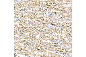 Immunohistochemistry of paraffin-embedded human liver using STING/TMEM173 Rabbit pAb (ABIN1683049, ABIN3017833, ABIN3017834 and ABIN6220283) at dilution of 1:50 (40x lens). (STING/TMEM173 Antikörper  (AA 170-379))