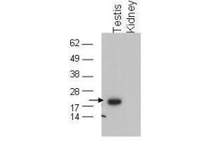 Western blot using  affinity purified anti-GPx4 to detect GPx4 in testis extract (arrow). (GPX4 Antikörper  (C-Term))