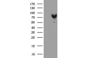 HEK293T cells were transfected with the pCMV6-ENTRY control (Left lane) or pCMV6-ENTRY MPP5 (Right lane) cDNA for 48 hrs and lysed. (MPP5 Antikörper)