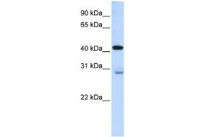 GRAMD2 antibody used at 1 ug/ml to detect target protein. (GRAMD2 Antikörper  (Middle Region))