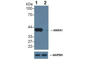 Knockout Varification: ;Lane 1: Wild-type Hela cell lysate; ;Lane 2: ANXA1 knockout Hela cell lysate; ;Predicted MW: 39kDa ;Observed MW: 39kDa;Primary Ab: 2µg/ml Mouse Anti-Human ANXA1 Antibody;Second Ab: 0. (Annexin a1 Antikörper  (AA 1-346))