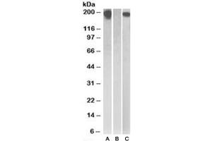 Western blot testing of HEK293 lysate overexpressing Human CSF1R with MYC tag with CSF1R antibody (0. (CSF1R Antikörper)