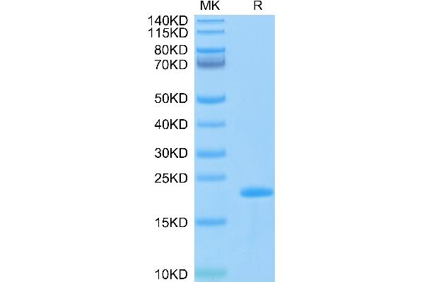 SARS-CoV-2 Nucleocapsid Protein (SARS-CoV-2 N) (AA 243-364) (His-Avi Tag,Biotin)