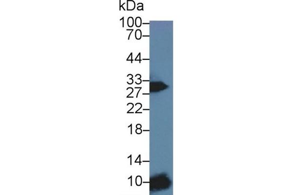 CD79a Antikörper  (AA 30-193)