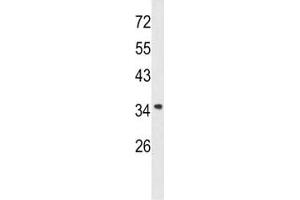 Western blot analysis of Annexin A1 antibody and A2058 lysate. (Annexin a1 Antikörper  (AA 129-158))