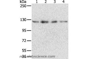Western blot analysis of Huvec, hepg2, 293T and A549 cell, using RBM5 Polyclonal Antibody at dilution of 1:500 (RBM5 Antikörper)