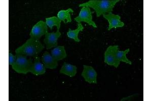 Immunofluorescence staining of A549 cells with ABIN7170322 at 1:50, counter-stained with DAPI. (SOS2 Antikörper  (AA 187-404))