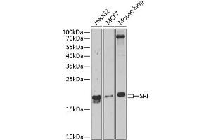 Western blot analysis of extracts of various cell lines, using SRI Antibody  at 1:1000 dilution. (SRI Antikörper  (AA 1-198))