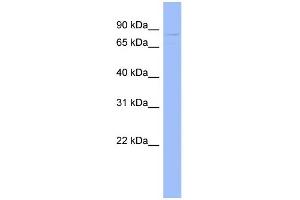 WB Suggested Anti-GPD2 Antibody Titration:  0. (GPD2 Antikörper  (N-Term))