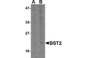 Western Blotting (WB) image for anti-Bone Marrow Stromal Cell Antigen 2 (BST2) (N-Term) antibody (ABIN1031283) (BST2 Antikörper  (N-Term))