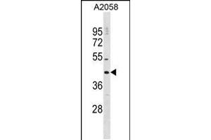 Western blot analysis in A2058 cell line lysates (35ug/lane). (DNAJC25 Antikörper  (AA 211-239))