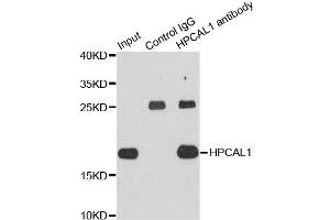 Immunoprecipitation analysis of extracts of HepG2 cells using HPCAL1 antibody (ABIN4903961). (HPCAL1 Antikörper)