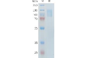 Human R1(21-521 1097-1246) Protein, His Tag on SDS-PAGE under reducing condition. (PLA2R1 Protein (AA 21-521, AA 1097-1246) (His tag))
