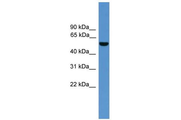 ALDH9A1 Antikörper  (C-Term)