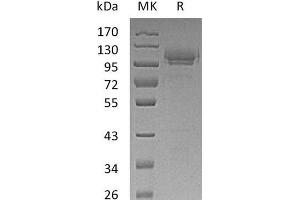 CADM1 Protein (Fc Tag)