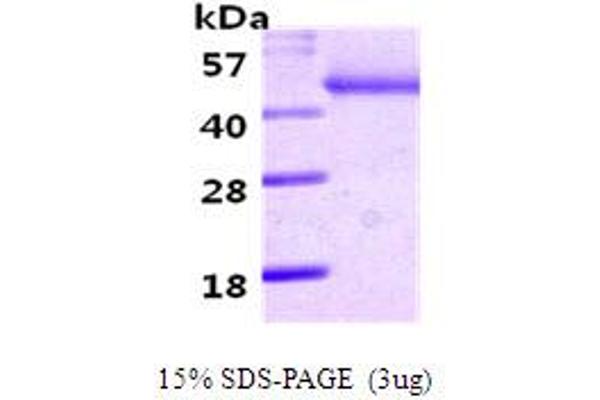 SERPINA12 Protein (AA 21-414) (His tag)