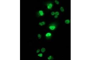 Anti-TP53 mouse monoclonal antibody (ABIN2454551) immunofluorescent staining of COS7 cells transiently transfected by pCMV6-ENTRY TP53 (RC200003). (p53 Antikörper)