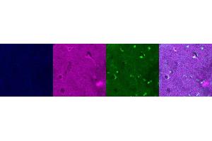 Immunohistochemistry (IHC) image for anti-Interleukin 10 (IL10) antibody (ABIN7456056)