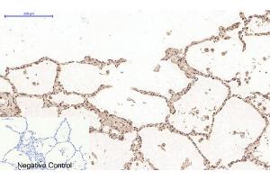 Immunohistochemistry (IHC) image for anti-Desmin (DES) antibody (ABIN5958489) (Desmin Antikörper)