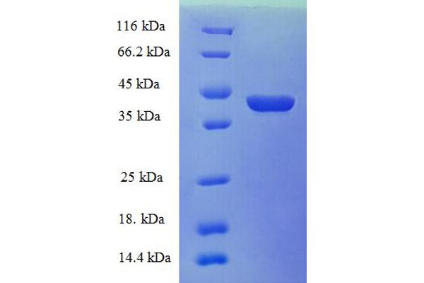 CRABP1 Protein (AA 2-137) (GST tag)