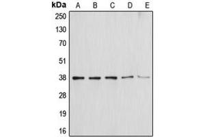 Western blot analysis of Annexin A1 expression in HEK293T (A), NIH3T3 (B), THP1 (C), Molt4 (D), HepG2 (E) whole cell lysates. (Annexin a1 Antikörper  (Center))