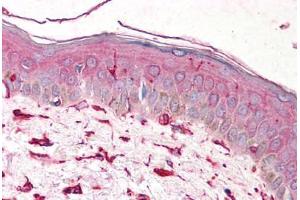 Human Skin (formalin-fixed, paraffin-embedded) stained with VIM antibody ABIN239818 at 5 ug/ml followed by biotinylated anti-mouse IgG secondary antibody ABIN481714, alkaline phosphatase-streptavidin and chromogen. (Vimentin Antikörper)