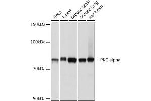 Western blot analysis of extracts of various cell lines, using PKC alpha pAb (ABIN6128460, ABIN6135858, ABIN6135859 and ABIN7101370) at 1:1000 dilution. (PKC alpha Antikörper)