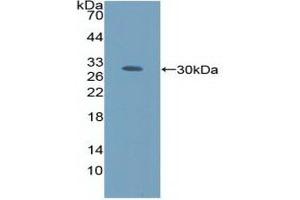 Detection of Recombinant AMFR, Human using Polyclonal Antibody to Autocrine Motility Factor Receptor (AMFR) (AMFR Antikörper  (AA 456-643))