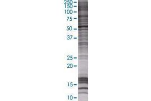 AIPL1 transfected lysate. (AIPL1 293T Cell Transient Overexpression Lysate(Denatured))