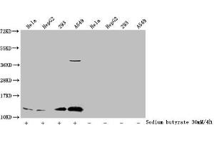 Western Blot Detected samples: Hela whole cell lysate, HepG2 whole cell lysate, 293 whole cell lysate, A549 whole cell lysate, Untreated (-) or treated (+) with 30 mM sodium butyrate for 4h All lanes: HIST1H4A antibody at 1:1000 Secondary Goat polyclonal to rabbit IgG at 1/40000 dilution Predicted band size: 12 kDa Observed band size: 12 kDa (HIST1H4A Antikörper  (acLys91))