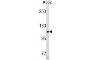 Western Blotting (WB) image for anti-Usher Syndrome 1C (Autosomal Recessive, Severe) (USH1C) antibody (ABIN3001013) (USH1C Antikörper)